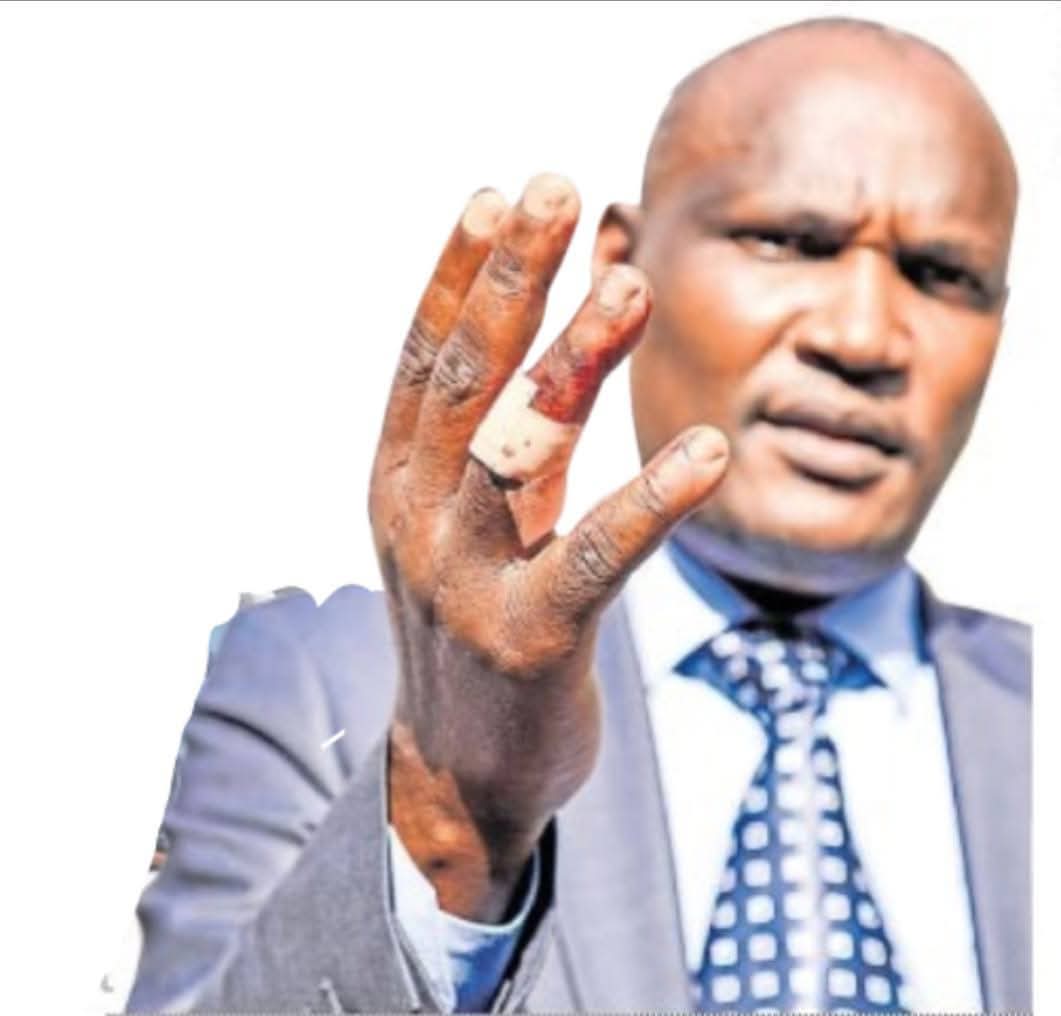 AgungaRodgers's tweet photo. On 29 December 2021, National Assembly Minority Leader John Mbadi got into a fistfight with Sigowet-Soin MP Benard Koros during a heated vote on the Political Parties Amendment Bill, 2021. https://t.co/fnapwIWXtP