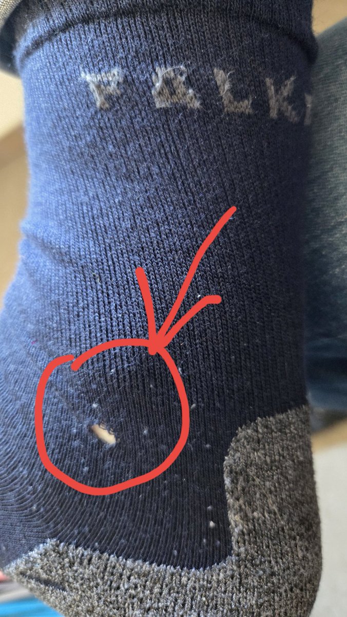 Dear <a href="/FALKEsport/">FALKE Ergonomic Sport System</a>, after 2 month of using my New gear, these holes coming into my socks. Isn't That kind of Quick?
Hope you can help me out on this?