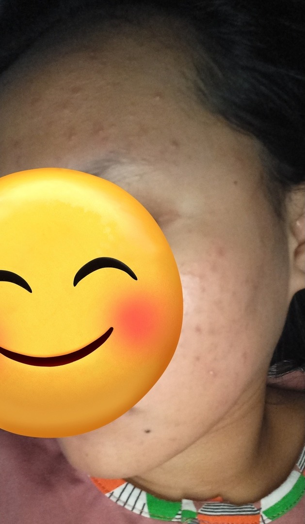 ✨OMBB | 🚫NO LINK tweet media