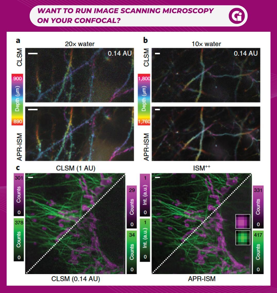 🚀 Ever wished your confocal could do super-resolution?
Now you can — with the PRISM Light kit. Image Scanning Microscopy with SPAD-array in commercial confocal systems: 🧠 Neuroscience 🔬 Deep Imaging 🌈 Multicolor ISM. Check out Figure 3: nature.com/articles/s4159…