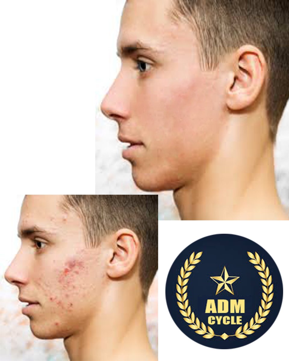 moduadam80's tweet image. Back to Graphic design and Video editing for a well.

Ready to work with any company, propfirm or individual works, just me in touch.

#Graphicsdesign #graphicsdesigner #videoeditor #logodesigner #flyerdesign