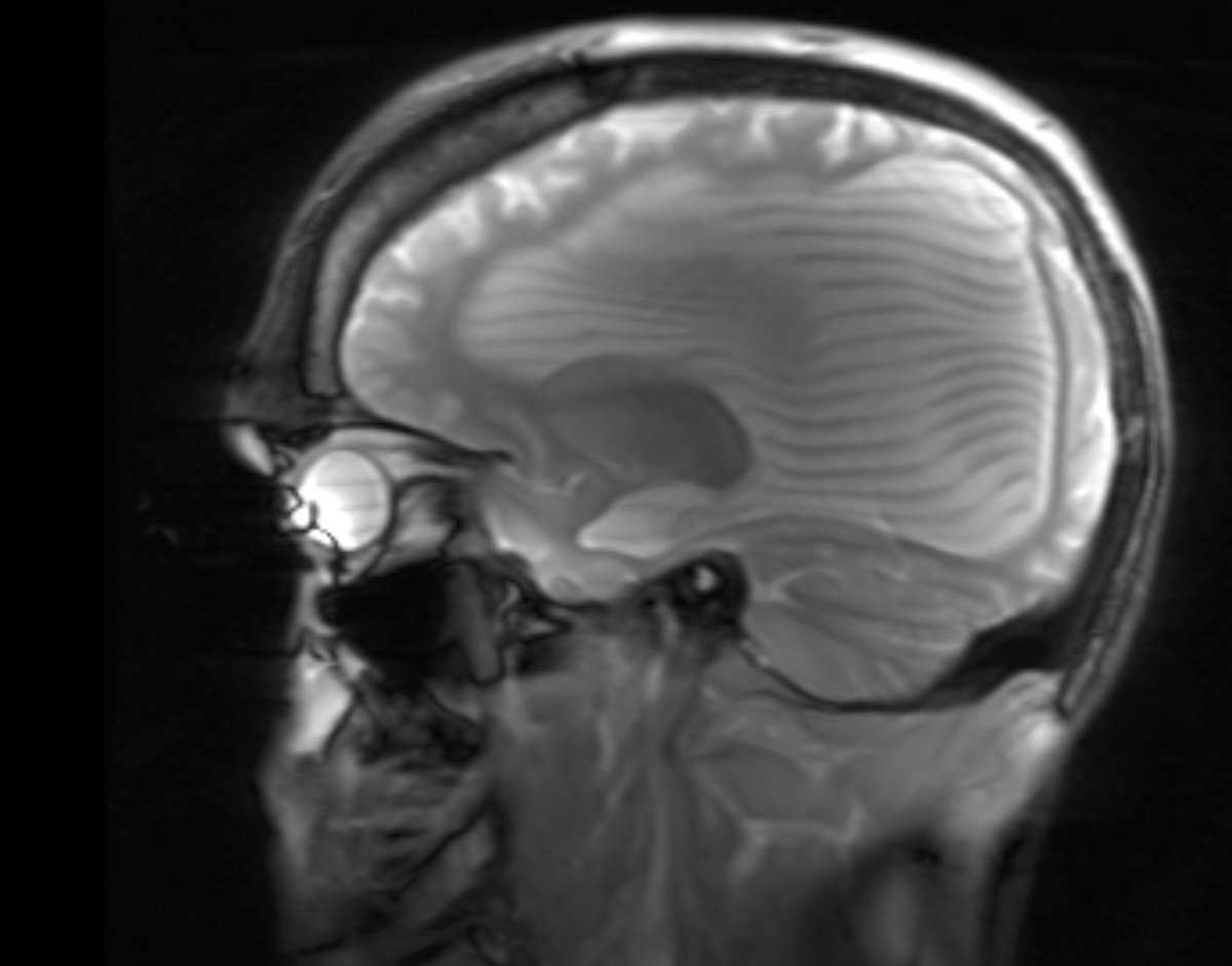 I failed to get better in any capacity for the past 34 years, because I have been kept incredibly sick🤢🤮 without a prescription for benzos for a documented but obscured diagnosis for a seizures condition.

Every day has been incredibly difficult to live, as i am without a drug