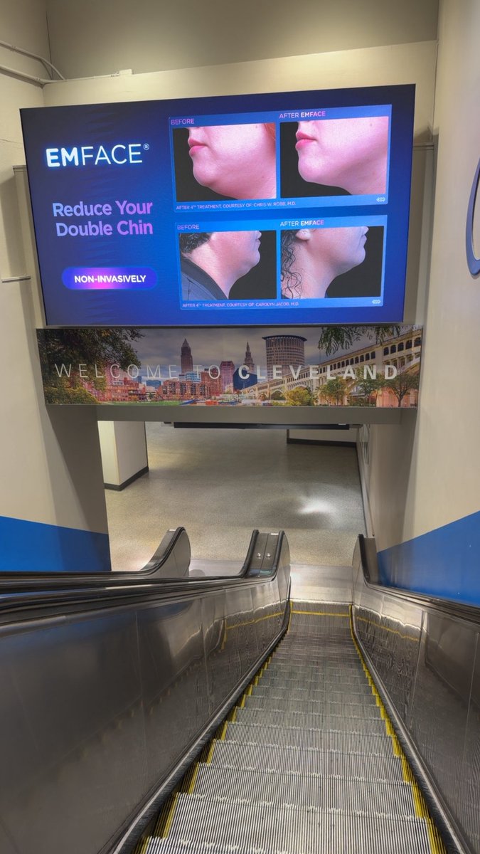 iam_the_code's tweet image. One step at a time🤓