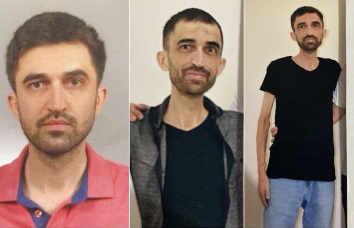 4 yaşından beri kronik böbrek hastası olan Mehmet Parlak, nakilli tek böbreği ile hayata tutunuyor. Cezaevi şartlarından dolayı rahatsızlanıp, tedavisi ihmal edilen 63 kilodan 40 kiloya kadar düşen Parlak'ın tek böbreği artık %20 çalışıyor. <a href="/profdrhalukkoc/">HALUK KOÇ</a>

HastalarıÖzgür Bırakın