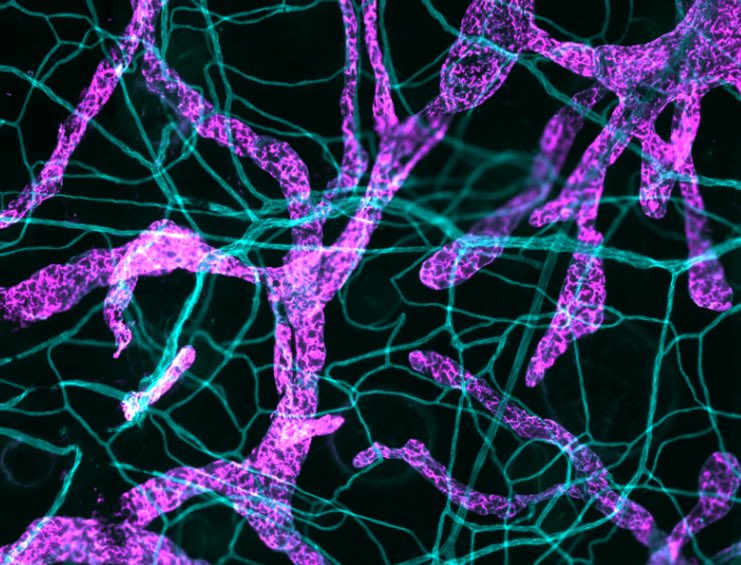 Steffen Storck (@sestorck) on Twitter photo Submit your abstract to the 2026 #Lymphatics  #GRC (March 1st – 6th) and #GRS (for junior investigators, Feb 28th – March 1st) which I will be chairing. The speaker lineup is fantastic! Hurry up before it will be oversubscribed! grc.org/lymphatics-con…
<a href="/GordonConf/">Gordon Research Conferences</a> Submit your abstract to the 2026 #Lymphatics  #GRC (March 1st – 6th) and #GRS (for junior investigators, Feb 28th – March 1st) which I will be chairing. The speaker lineup is fantastic! Hurry up before it will be oversubscribed! grc.org/lymphatics-con…
<a href="/GordonConf/">Gordon Research Conferences</a>