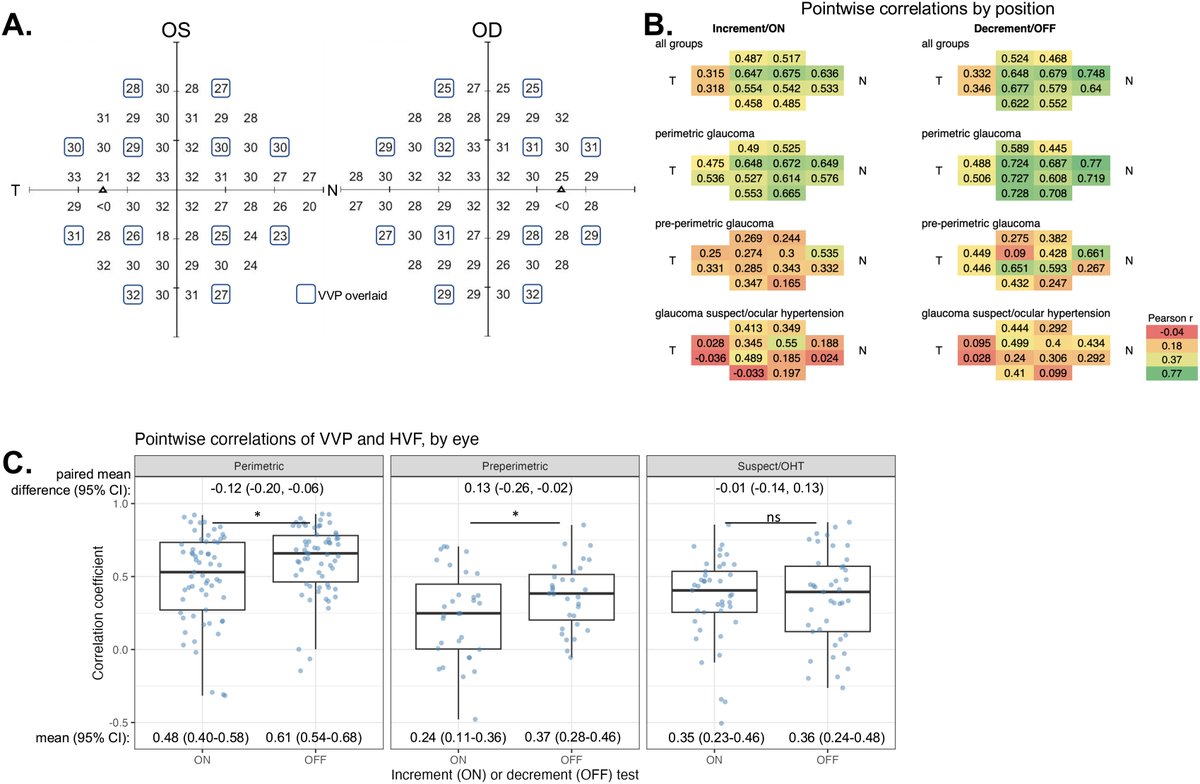 Evaluating incremental and decrement stimuli responses in glaucoma patients using virtual reality-based perimetry
ow.ly/UExY50WQtFQ
#ophthalmology