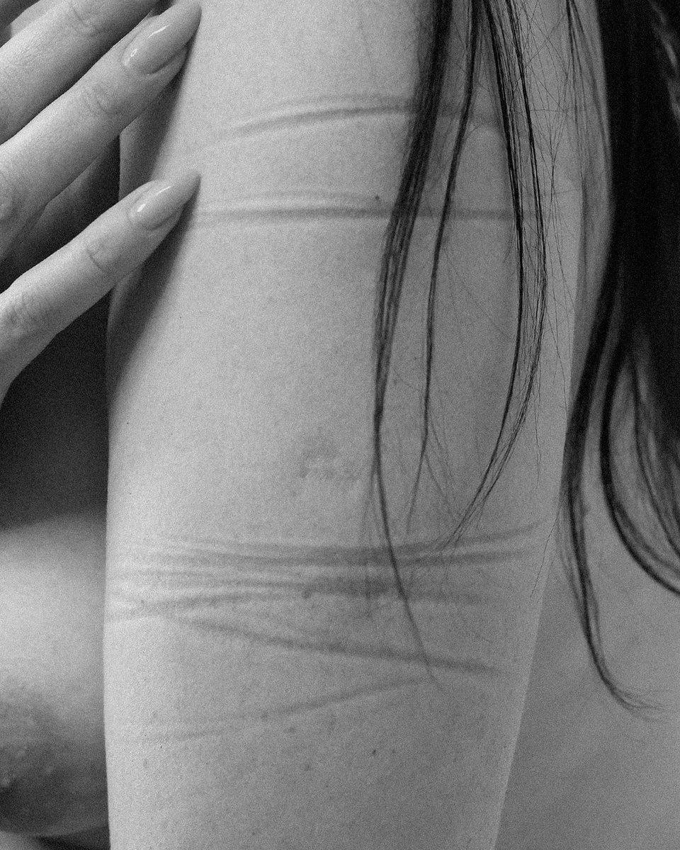 ashsphri's tweet photo. Some #scars don’t break the #skin. They shape it. https://t.co/XEHKDcJGuV