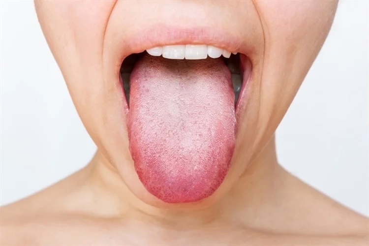 Aller_MD's tweet image. #Ozone exposure weakens #lung #function and reshapes the #oral #microbiome: scientists reveal that short-term ozone inhalation doesn’t just harm the lungs; it reshapes the microbes in the mouth, with men facing the greatest risks. news-medical.net/news/20251001/…