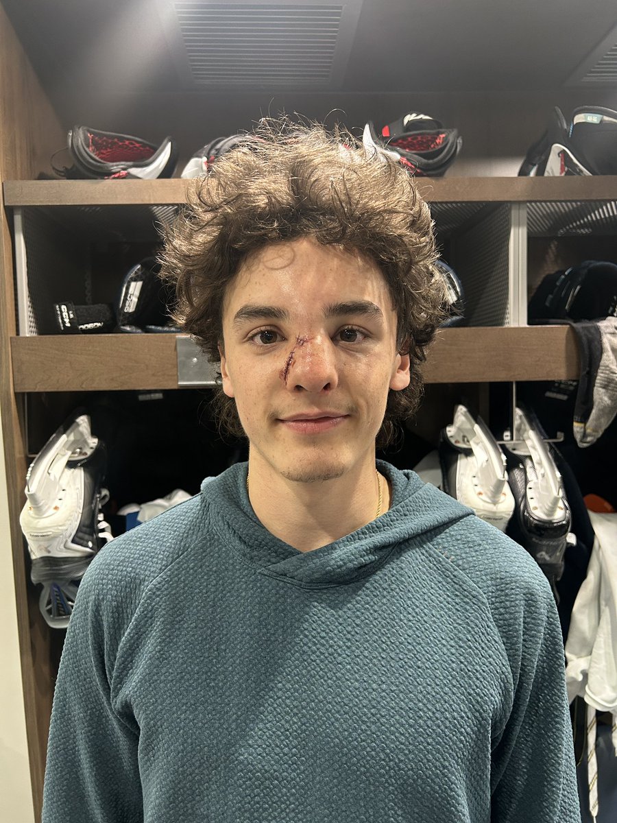 Fearless warrior Cullen Ingebritson back at the rink today after a friendly encounter with a puck yesterday afternoon and a long night at the hospital! 🤕👊🏼