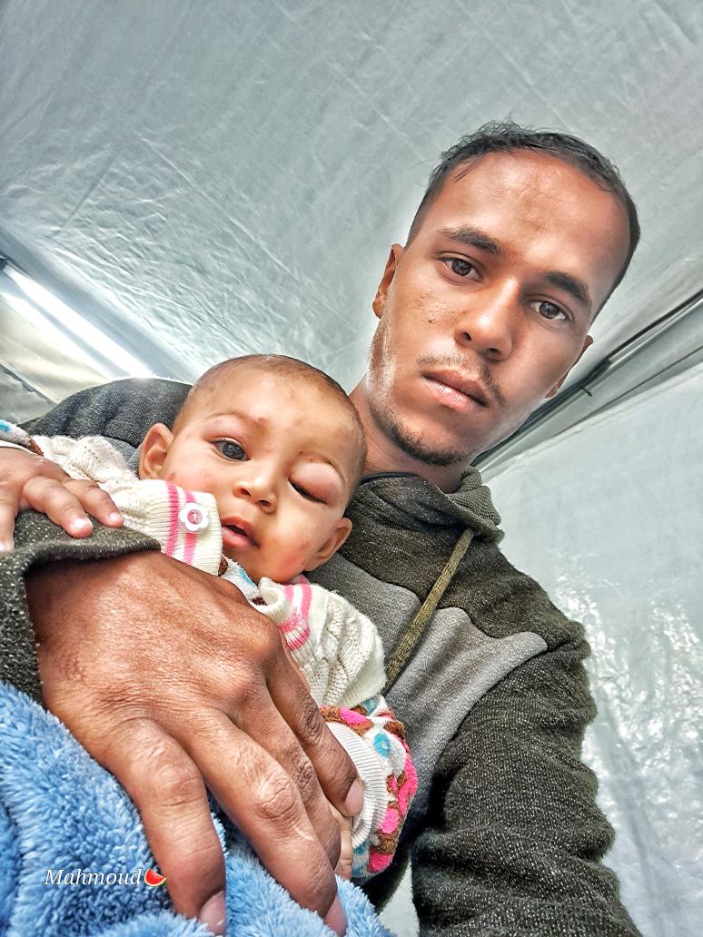 MY CHILD Will DIE . UNFORTUNATELY, Tasneem has a serious skin disease that's eating away at her skin, affecting her health. Her eyes are swollen and burning severely, and pimples are spreading mercilessly across her body. The weather is making things worse. Tasneem is crying