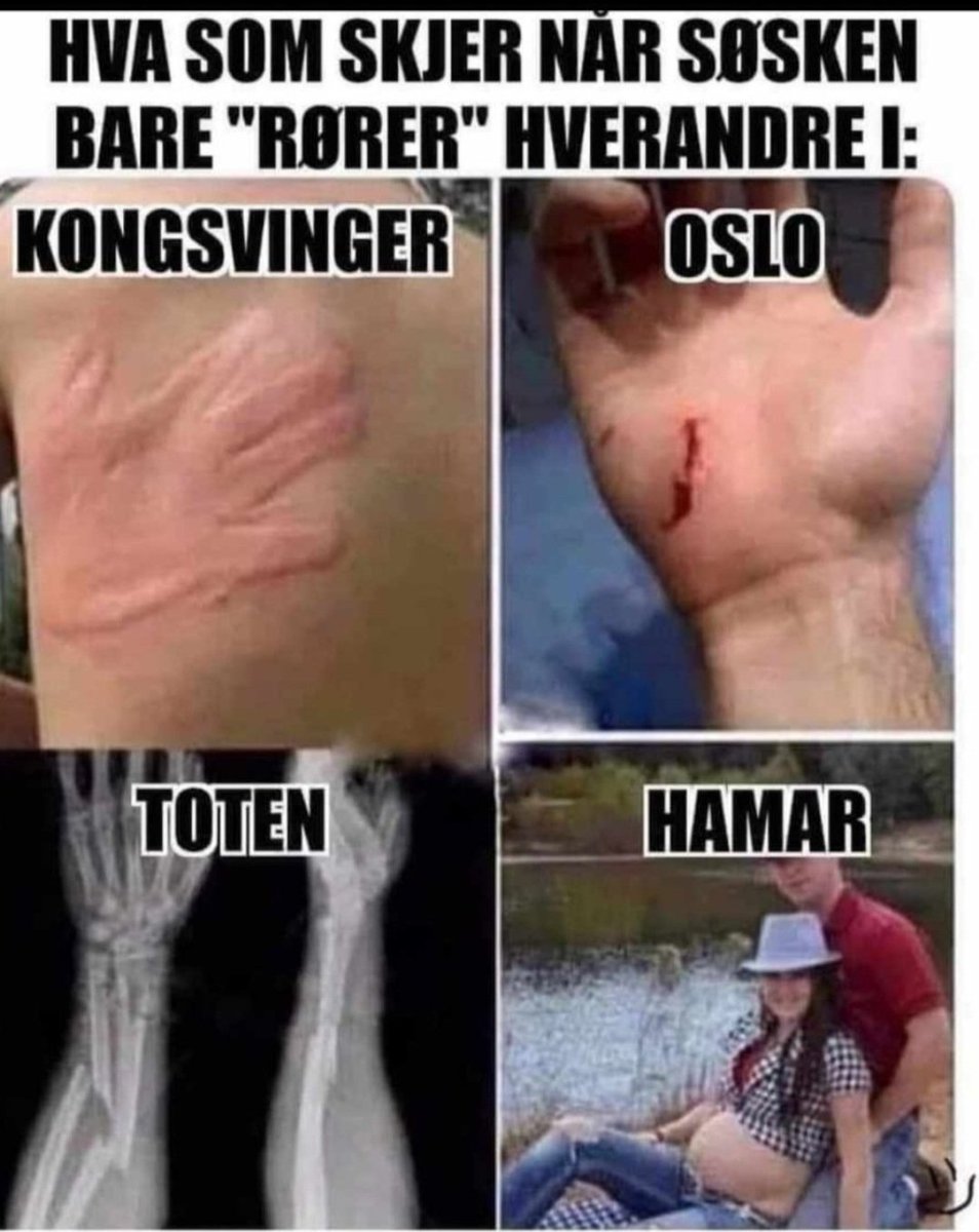 Hamar away✅️🥥