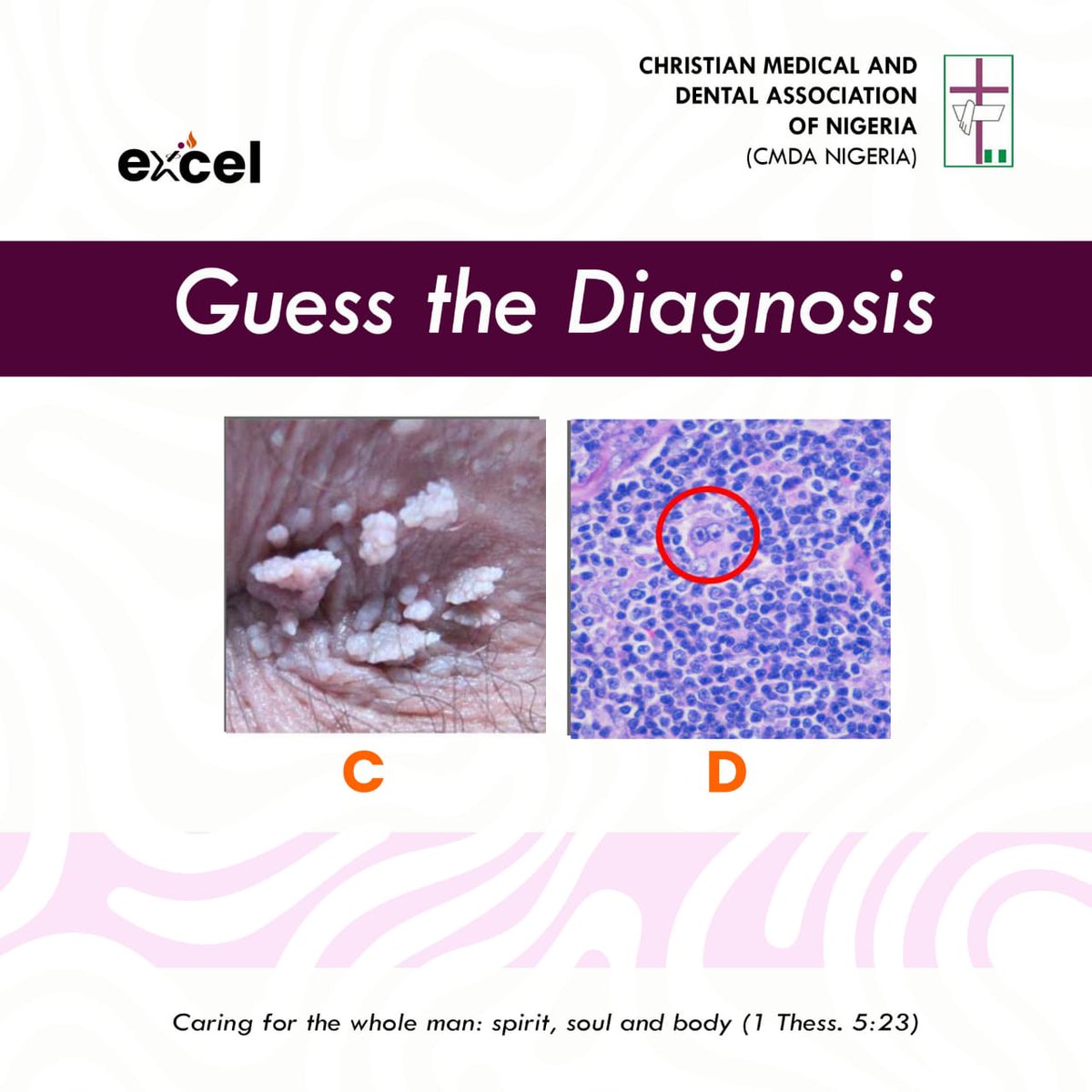 Guess the Diagnosis💫

#MedTwitter 
#Medics
