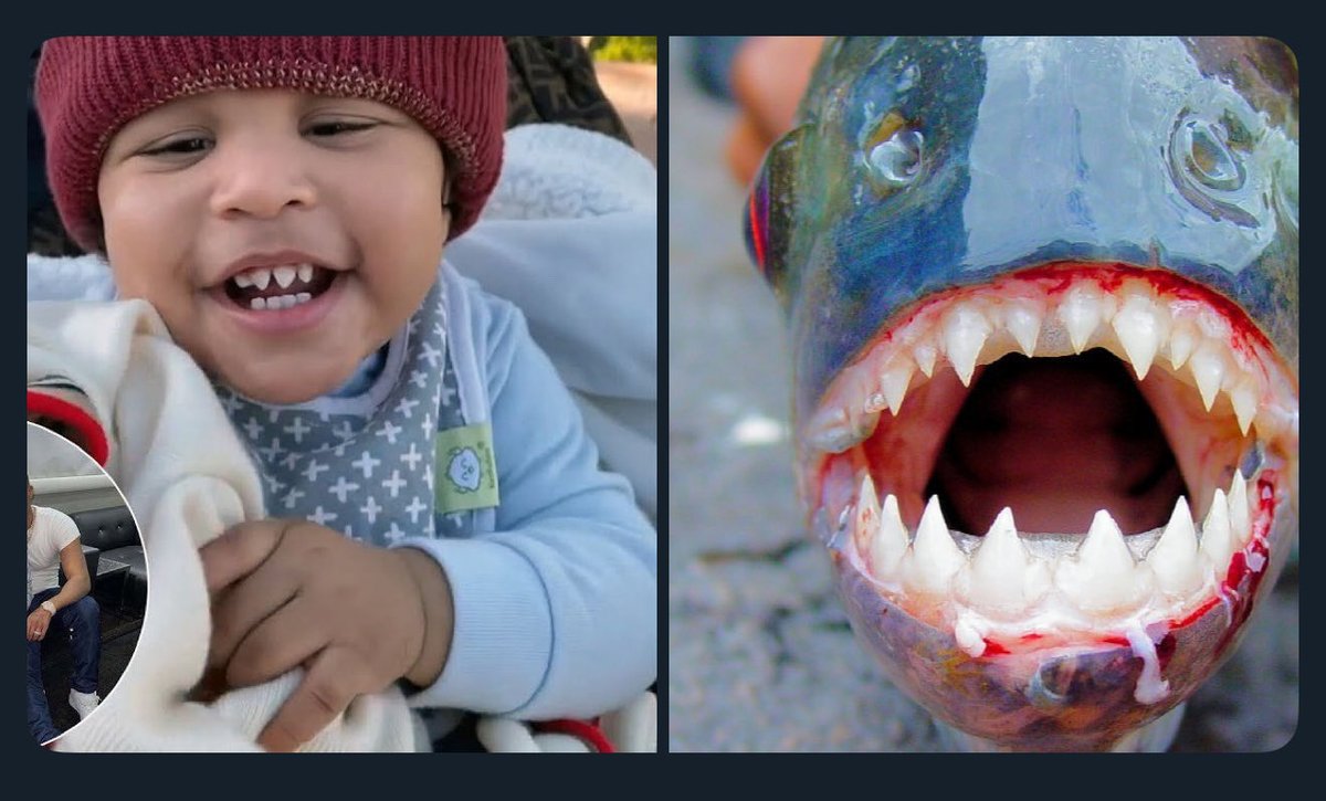 I know Texas chainsaw massacre teeth not jumping in 

<a href="/NICKIMINAJ/">Nicki Minaj</a>