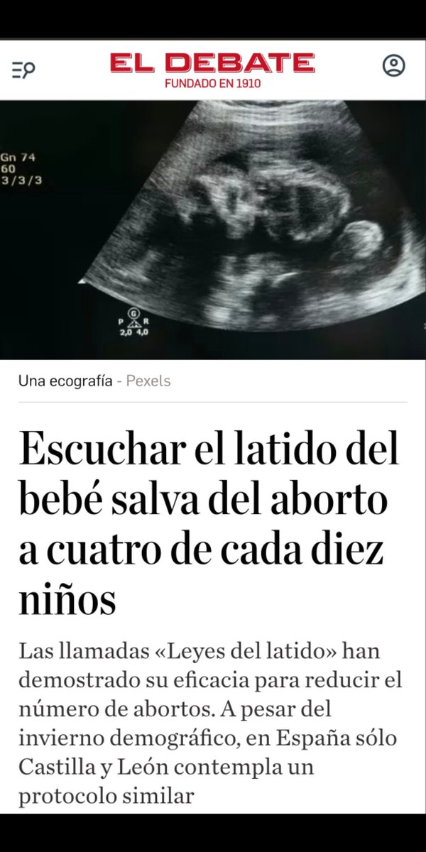 Por algo los abortistas bajan el volumen del ecógrafo y corren la pantalla para que la mamá no lo vea.