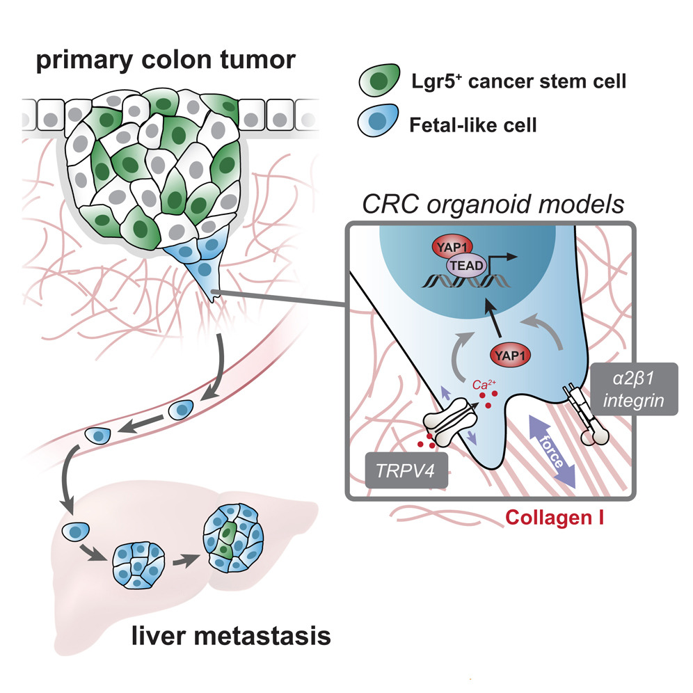 Intestinal_Cell's tweet image. 🧫 Using colorectal cancer (CRC) #organoid models, researchers demonstrated that mechanical interactions with collagen I, a main constituent of the interstitial matrix, instruct the reprogramming of CRC cells.
@UMCU_Intl | bit.ly/4mAUHEy