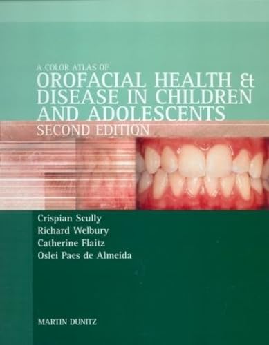 imulibrary's tweet image. 📢 A Color Atlas of Orofacial Health & Disease in Children & Adolescents : Diagnosis and Management by Crispian Scully et al., is now available on ProQuest Ebook Central
🔗Read e-book here: ezp2.imu.edu.my/login?auth=shi…
Thank you
#IMUUniversityLibrary #eBooks #ProQuestEbookCentral