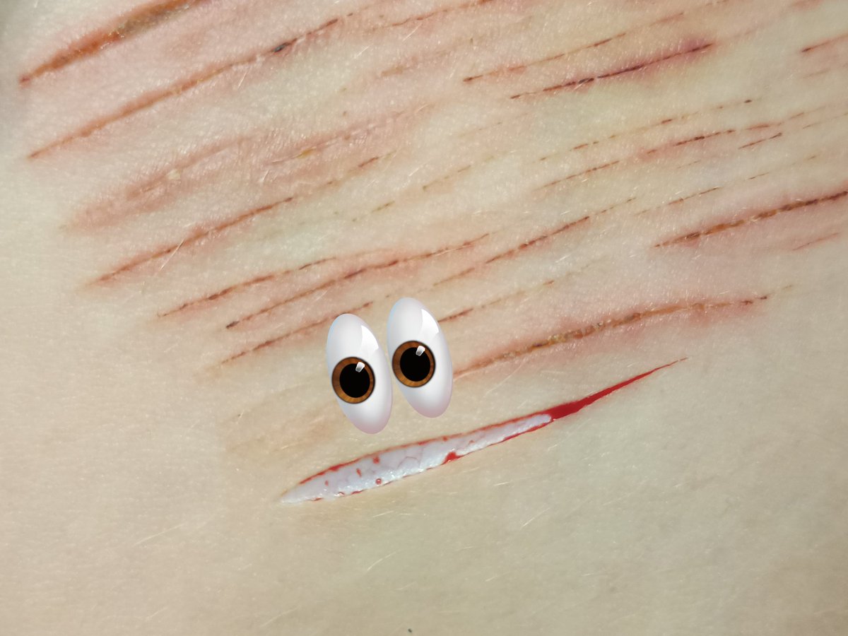 teptep~—⁠☆ tweet media