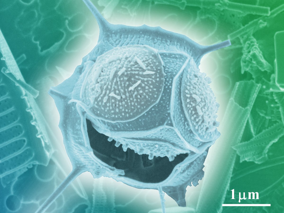 Hitachi_EM's tweet image. Happy World Smile Day ! ☺😄😁☻ (^_^)/
(October 3, 2025)
#ElectronMicroscope #electronmicroscopy #WorldSmileDay
“Smiling Pico-plankton”
For image details, visit hitachi-hightech.com/global/science…
This work was presented at the "photo contest" hosted by the Japanese Society of Microscopy.