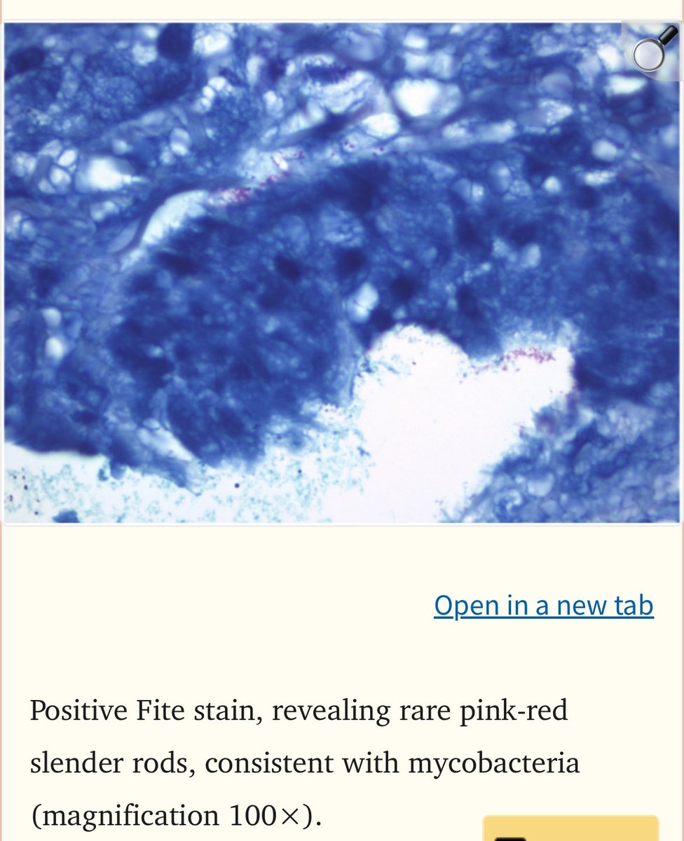 S.Enf.Infecciosas HRUM tweet media