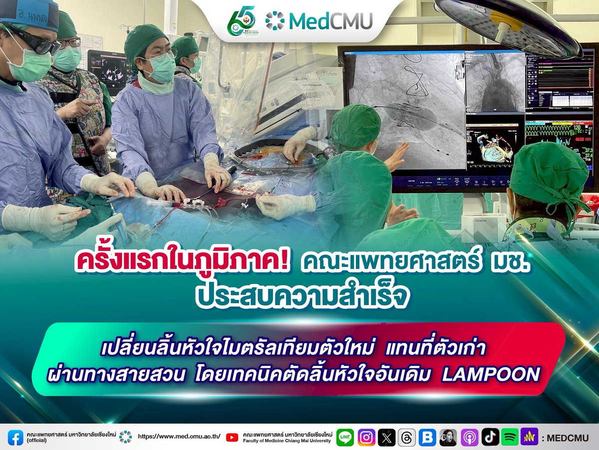 medcmuofficial's tweet photo. 🫀คณะแพทยศาสตร์ มหาวิทยาลัยเชียงใหม่ ประสบความสำเร็จ เปลี่ยนลิ้นหัวใจไมตรัลเทียมตัวใหม่ แทนที่ตัวเก่า ผ่านทางสายสวน เป็นรายแรกในระดับภูมิภาค

📍อ่านข่าวต่อ: https://t.co/GEispRX0bn

#LAMPOON #MedCMU #คณะแพทยศาสตร์มหาวิทยาลัยเชียงใหม่ #แพทย์เชียงใหม่ #โรงพยาบาลสวนดอก https://t.co/wzc6hbHLUM