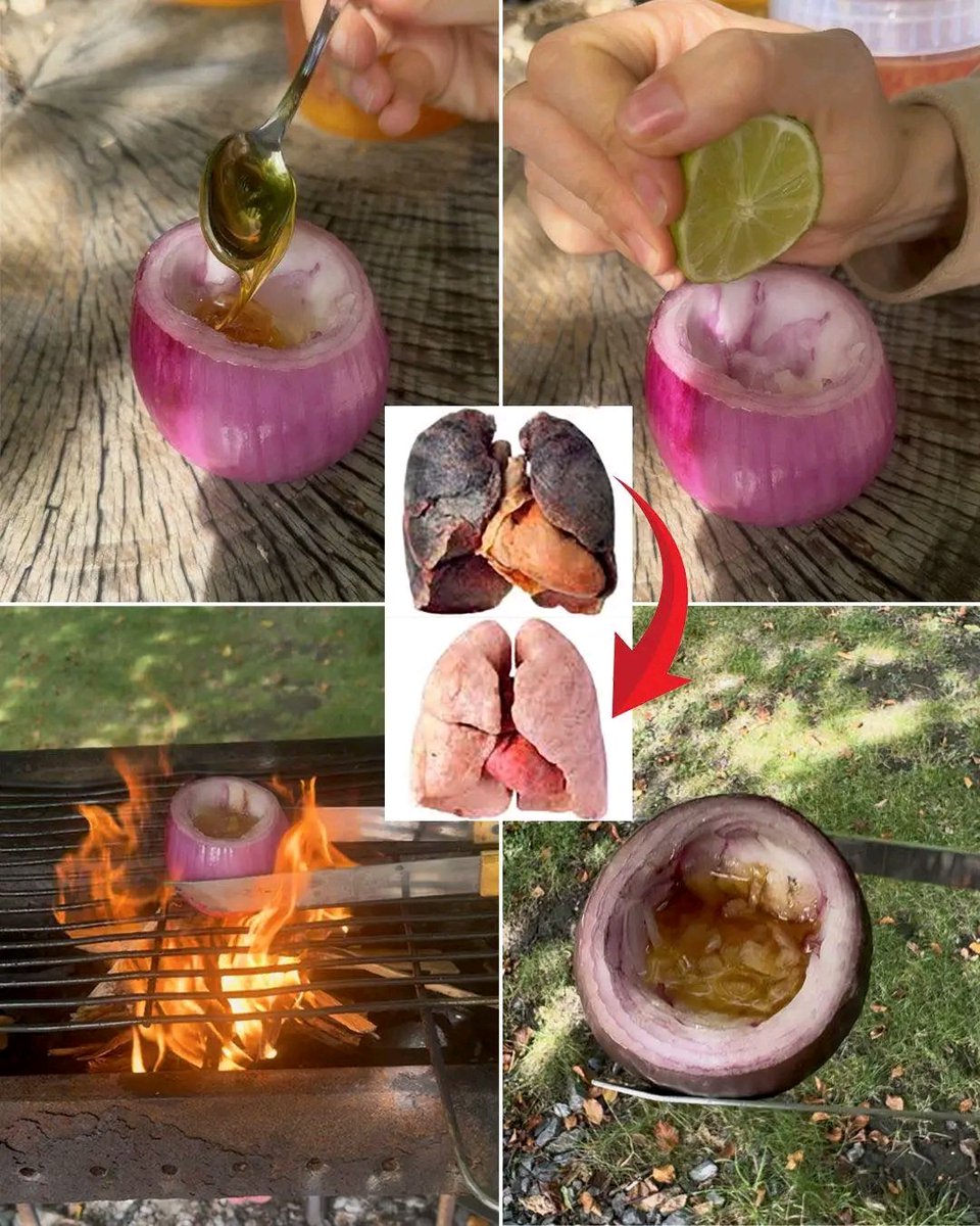 Herbalisque's tweet photo. 🚨 Stop the Cough Naturally! 🚨
This Onion Elixir melts mucus, fights infections &amp; clears your lungs fast. 🌿
Here’s how to make this powerful home tonic 👇 https://t.co/mGTL2Cf4F7