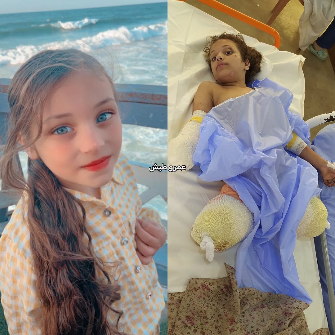 Unutmayın 

Terörist İsrail bunu yaptı