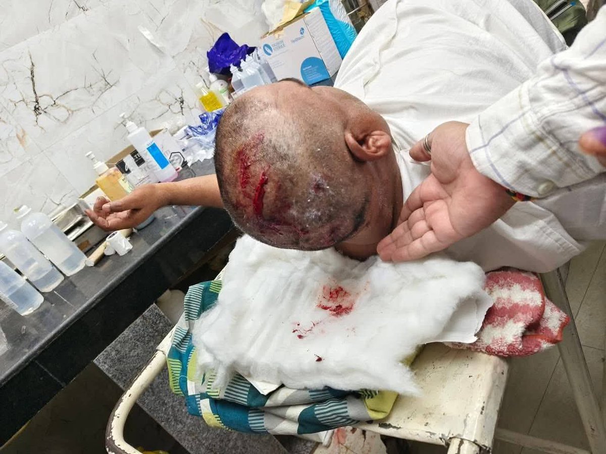 MrKumar8585's tweet photo. उप्र सरकार में मंत्री रहे , पिछड़ों के नेता गायत्री प्रजापति पर जेल में हुए जानलेवा हमले की निष्पक्ष न्यायिक जाँच हो।

उप्र में कहीं भी, कोई भी सुरक्षित नहीं है। https://t.co/yGq5dkdr68