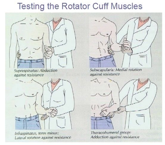 sara313y's tweet photo. Rot. Cuff tests: https://t.co/277xXEWZDh