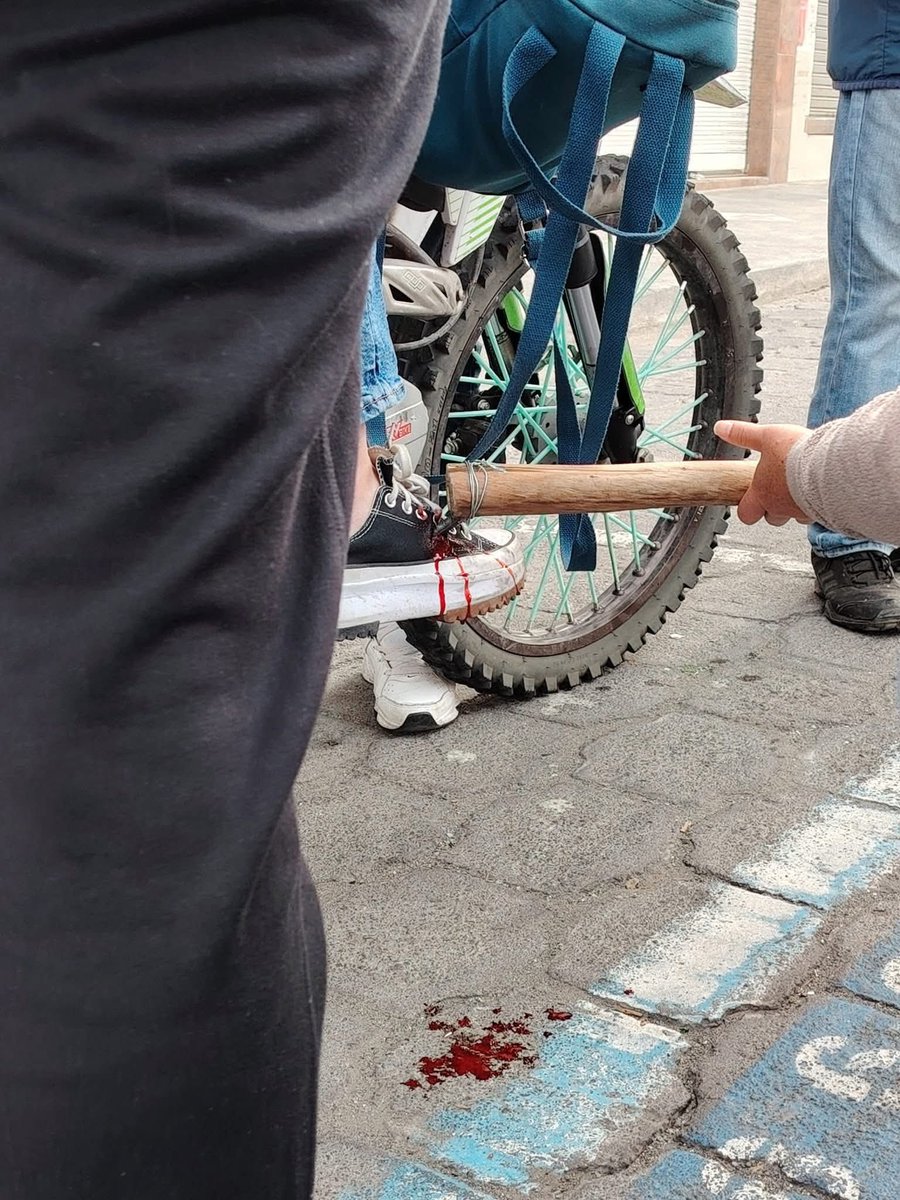 En medio centro de Otavalo 2 jóvenes fueron atacados con lanzas de clavos, una chica tiene una herida muy grave.

Esto no es protesta social es TERRORISMO.