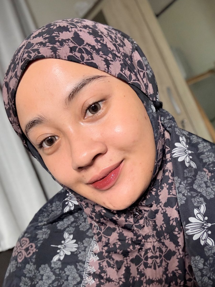 treatment botox di klinik            vs            botox-like rajin pake peptides

beda sih emg... tp jujur lebih suka yg kanan karena lebih natural, gak kaku, tp sama2 firm padet nyoyy✨