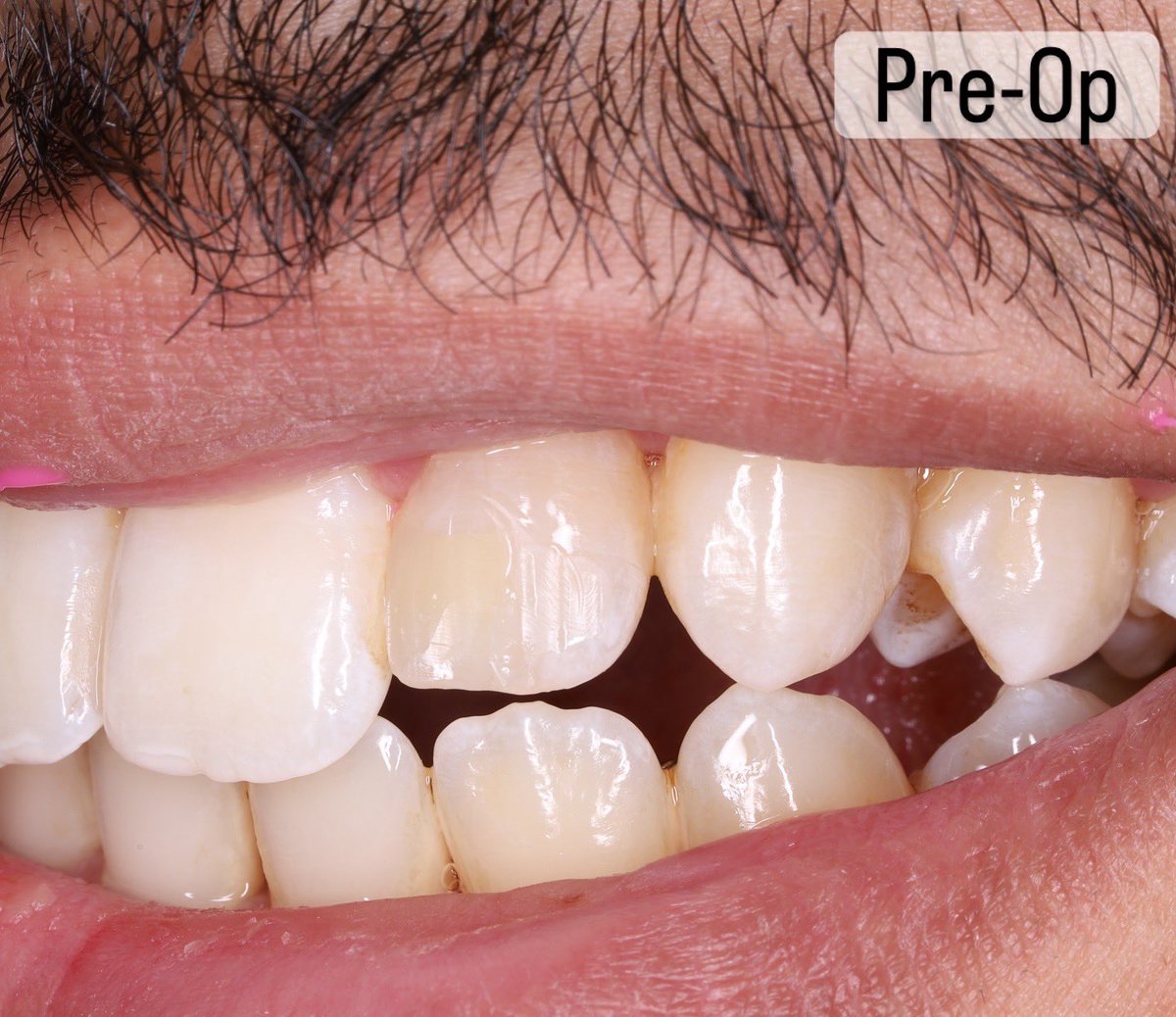 Nawaf Alghamdi tweet media