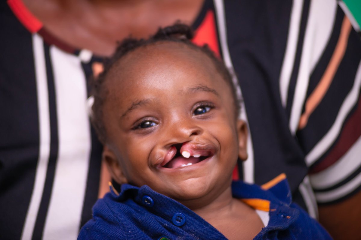 OS_DRC's tweet image. Every day, we celebrate smiles and the lasting impact of care. In honor of #WorldSmileDay, this week we’re highlighting how every action helps bring life-changing care within reach for children and families around the world...
linkedin.com/feed/update/ur…
#SmilesWithinReach