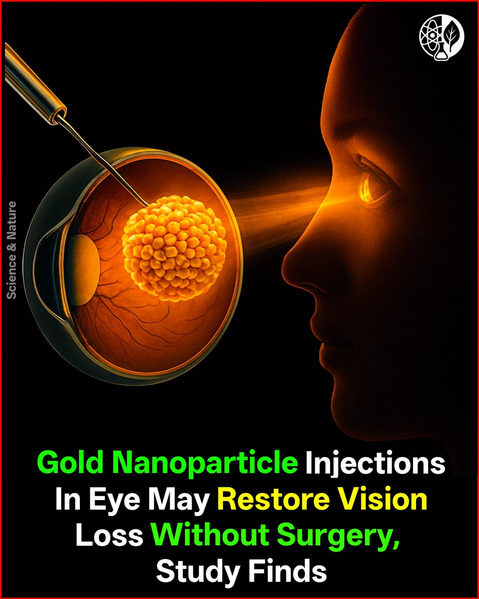 sci_astronomy's tweet image. 👁✨ Scientists may have found a way to restore lost vision without surgery.

By injecting gold nanoparticles into the eye, researchers showed they can act like artificial photoreceptors, bypassing damaged cells &amp;amp; bringing back sight in early studies.
#VisionRestoration #Nanotech
