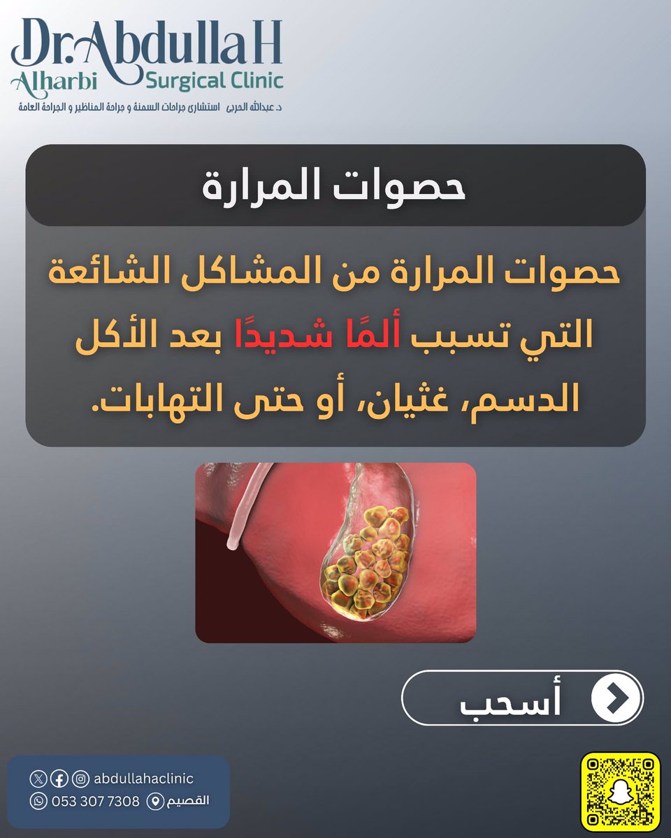 abdullahaclinic's tweet photo. كثير يسألون: هل ممكن نفَتّت حصوات المرارة مثل حصوات الكلى 
الجواب: ❌ لا يمكن
العلاج الأساسي هو استئصال المرارة بالمنظار عند وجود أعراض أو مضاعفات 
خطوة بسيطة تحميك من آلام ومشاكل كبيرة 

عيادة د. عبدالله الحربي 
0533077308

#القصيم #القصيم_الآن 
#حصوات_المرارة #التهاب_المرارة https://t.co/eSfZZot1Ry