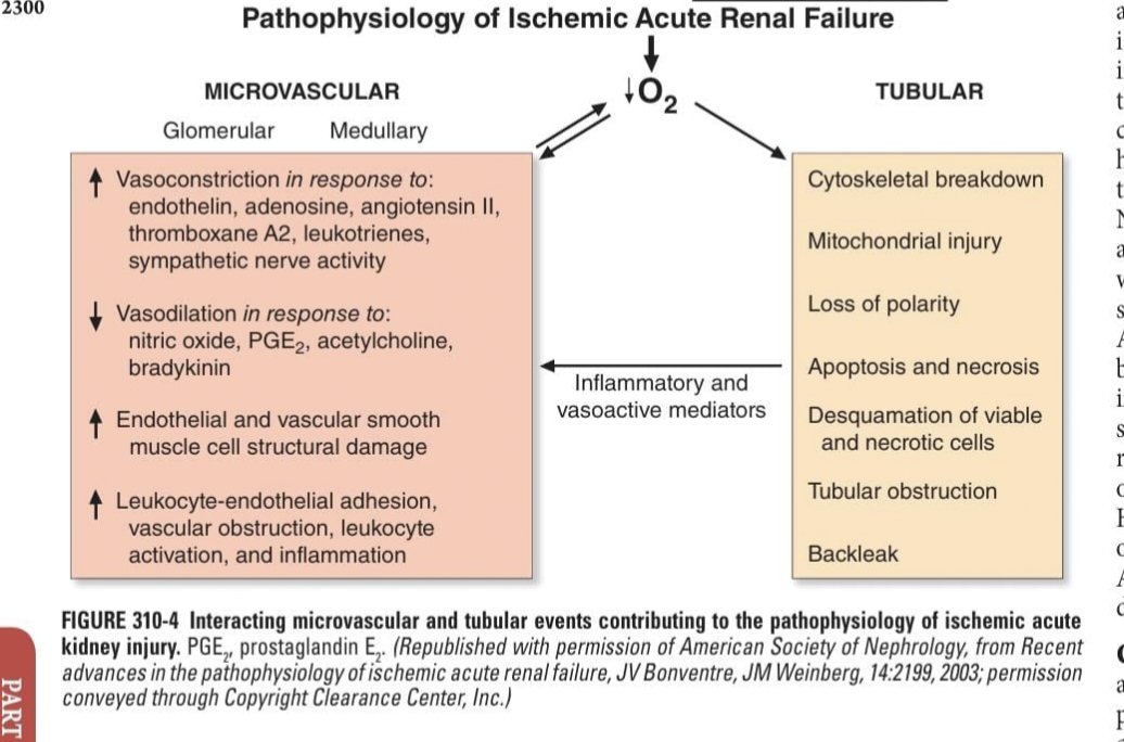 MEDUnlocked's tweet photo. Pathophysiology of ischemic aki https://t.co/fbp2hcA8Eh