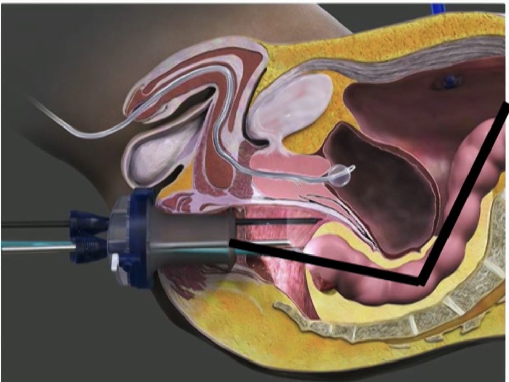 Gracias por la invitación de los compañeros de Madrid, Magnífica reunión e iniciativa a reproducir en otras comunidades
