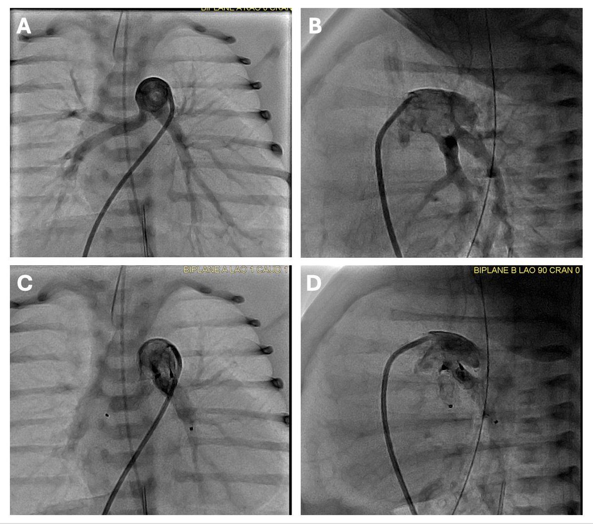 Congenital Cardiology Today tweet media