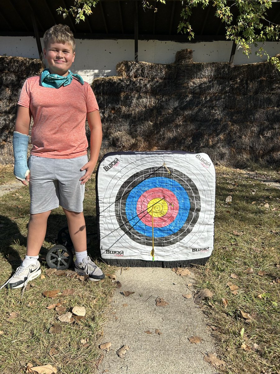 awmrpatterson's tweet photo. Taking over the Archery Range today at Camp Michindoh. Yes it is possible to get a bullseye with a broken hand😳🏹🎯 https://t.co/5nfTwKl1Fe