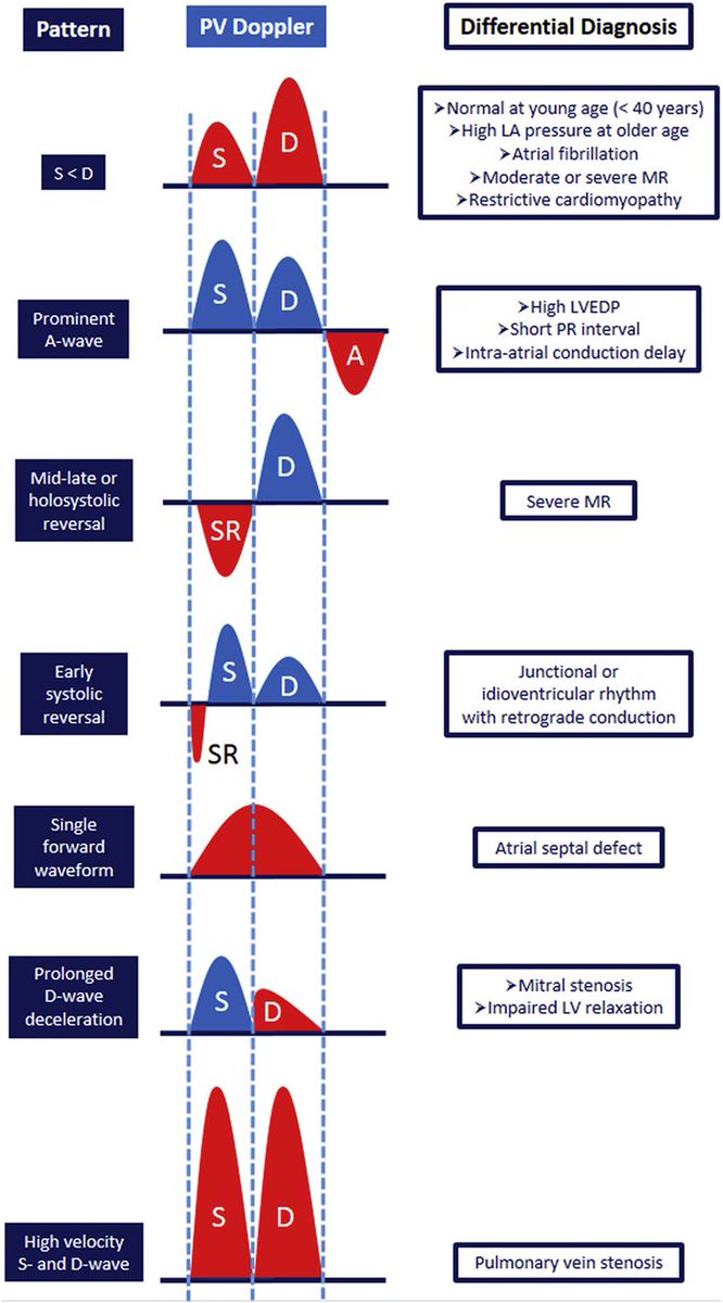 The image displays various patterns observed in Pulmonary Vein (PV) Doppler waveforms and their corresponding differential diagnoses.

onlinejase.com/article/S0894-…