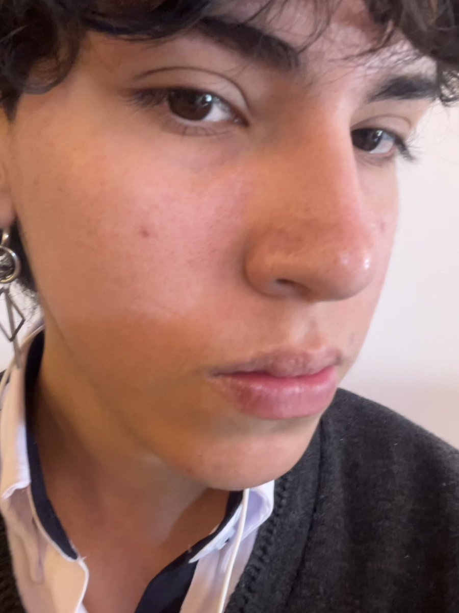 Relnnot's tweet image. decidí tocar pasto, salió sol y ya me insolé 😿😿