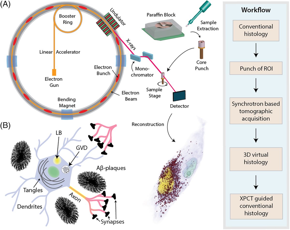 brainpathol's tweet image. 3D imaging of neuronal inclusions and protein aggregates in human neurodegeneration by multiscale x-ray phase-contrast tomography
onlinelibrary.wiley.com/doi/10.1111/bp…