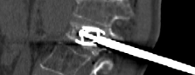 Interventional Oncology Institute tweet media