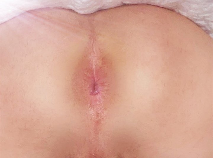 ابي خال يشقني مولع نار مفتوح