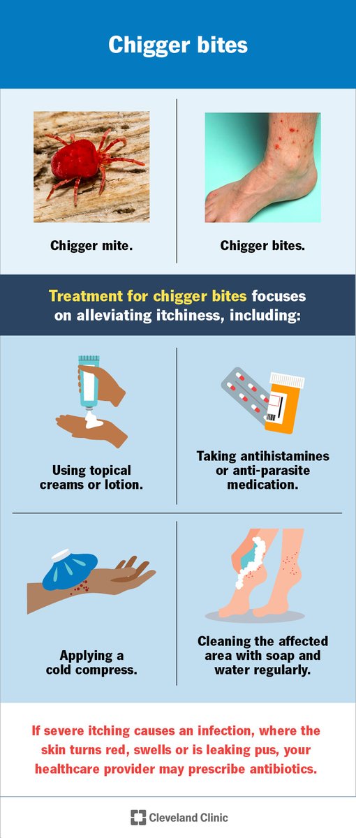 Today I Learned: that chiggers don't actually burrow under your skin, but instead drink your liquified skin through a straw they make out of dead skin cells.