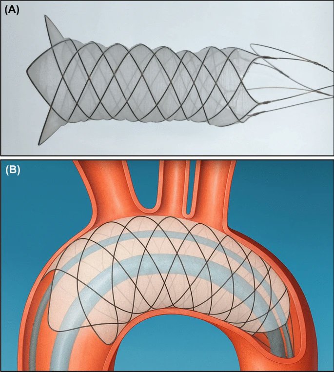 Satoshi Tateshima, MD, DMSc tweet media