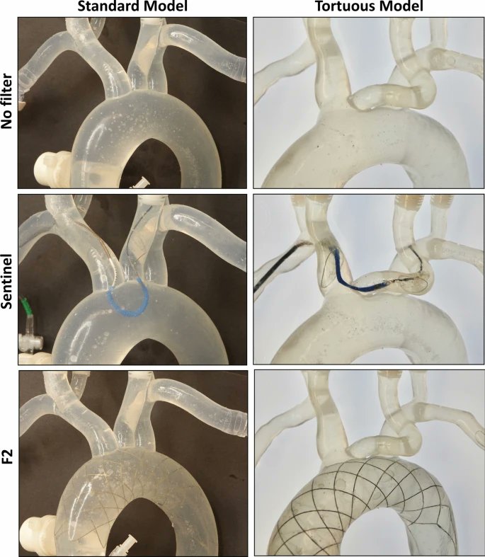 Satoshi Tateshima, MD, DMSc tweet media