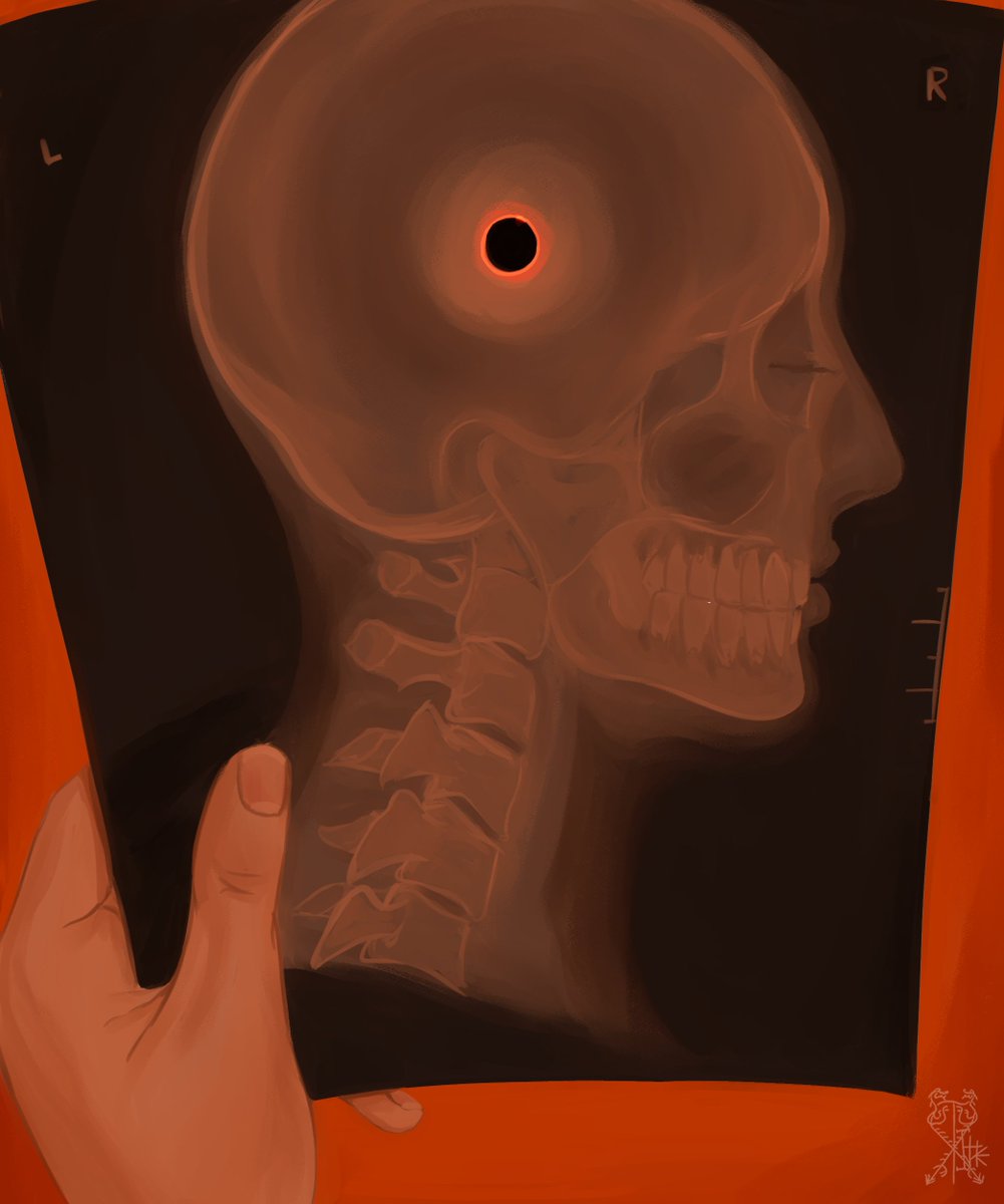 sanstitre2000's tweet photo. Brain Damage Eclipse https://t.co/a279JuYIwH