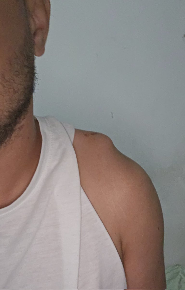 pedrofonso's tweet photo. to parecendo a Gaga na era born this way https://t.co/KTHRM8MHZT