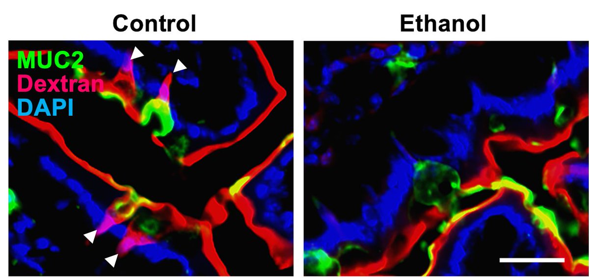 CristiLlorente's tweet image. The print version of our paper was published today in Nature. mAChR4-regulated GAPs train gut immune cells to maintain antimicrobial defense and prevent alcohol-associated liver disease. 
@Bernd_Schnabl @RayaTonetti 
nature.com/articles/s4158…