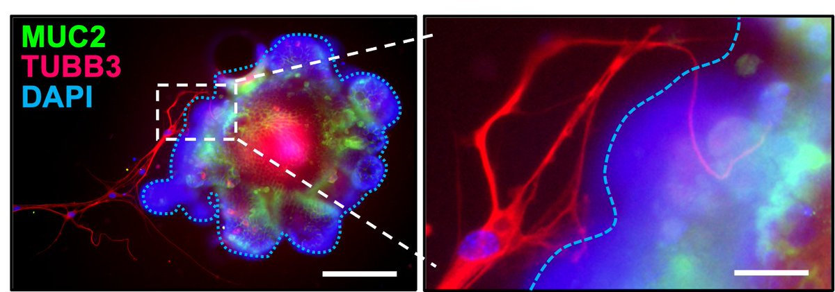 CristiLlorente's tweet image. The print version of our paper was published today in Nature. mAChR4-regulated GAPs train gut immune cells to maintain antimicrobial defense and prevent alcohol-associated liver disease. 
@Bernd_Schnabl @RayaTonetti 
nature.com/articles/s4158…